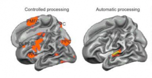 brain_activities